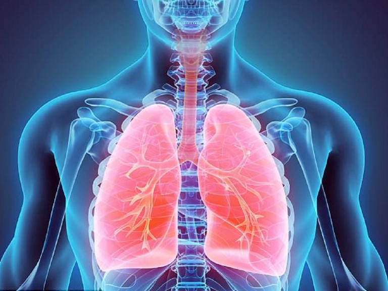 Viêm phổi không sốt là gì?